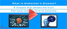 Alzheimer Disease Prevention and Treatment