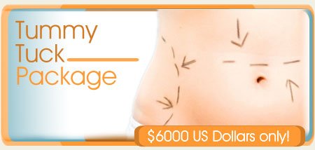 endoscopic tummy tuck