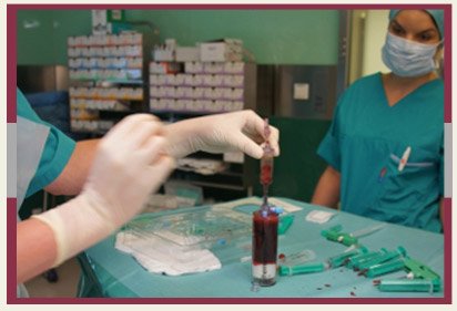 Cerebral Palsy Stem Cell Therapy Cerebral Palsy Stem Cell Therapy