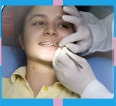 Best Orthodontics Services in Turkey Orthodontics