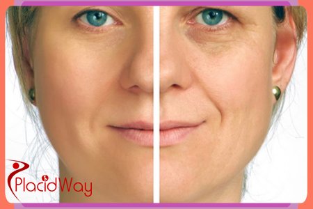Cosmetic Cell Therapies in Switzerland Cosmetic Cell Therapies in Switzerland Swiss Medica