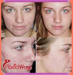 Anti-Aging and Skin Care Treatments Anti-Aging and Skin Care Treatments