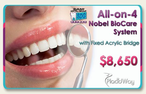 All on Four Nobel Biocare with fixed acrylic bridge package All on Four Nobel Biocare System with fixed acrylic bridge package