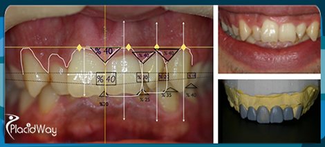 3D Aesthetic Dentistry at Dentart 3D Aesthetic Dentistry at Dentart