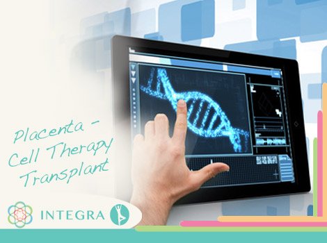 Placenta - Cell Therapy Transplant at Integra Medical Center Placenta - Cell Therapy Transplant at Integra Medical Center - Mexico