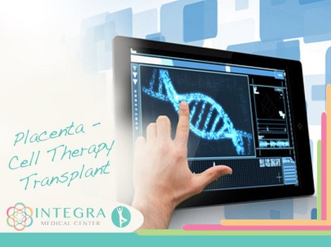 Placenta - Cell Therapy Transplant at Integra Medical Center Placenta - Cell Therapy Transplant at Integra Medical Center - Mexico