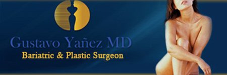 Bariatric Surgery in Mexico at Dr. Yanes in Tijuana Mexico banner
