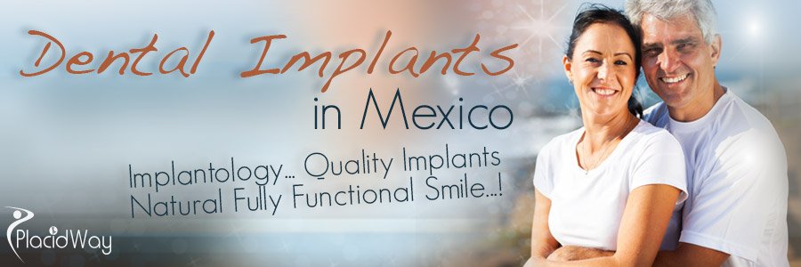 Best Dental Care in Mexico - Quality Implants in Latin America