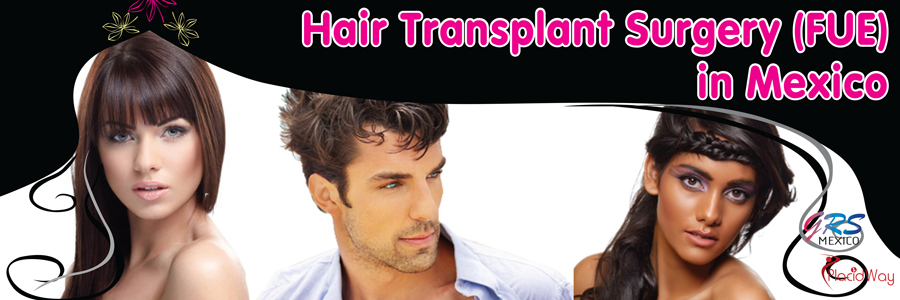 Fue Hair Transplant Mexico Hair Transplant In Mexico