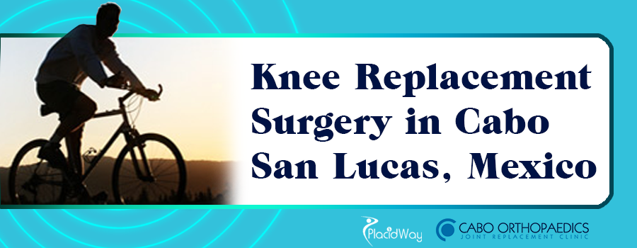 Knee Replacement Surgery in Cabo San Lucas, Mexico Knee Replacement Surgery in Cabo San Lucas, Mexico