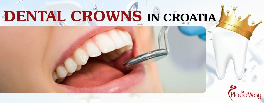 Dental Crowns Croatia