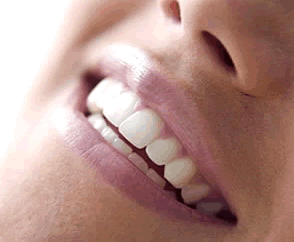 dental porcelain front