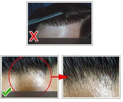 hair loss package