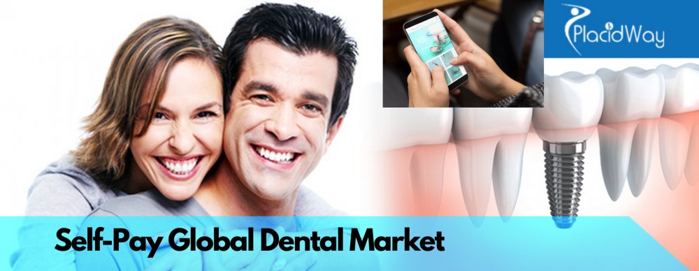 The Rise of Global Self-Pay Dental Market- How to Tap its Potentials?
