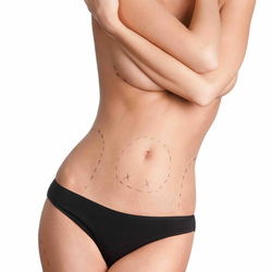 Best Liposuction with Tummy Tuck Package in New Delhi India 