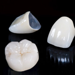 Dental Crowns in Los Algodones, Mexico at Sani Dental Group
