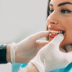 Full Mouth Restoration with Crowns in Los Algodones Mexico