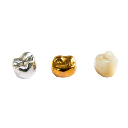 Best Package for Dental Implant in Tijuana, Mexico - $700