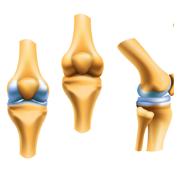 Affordable ACL Repair Surgery in Mexicali, Mexico