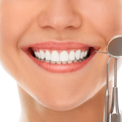 Dental Veneers in Costa Rica