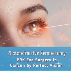 PRK Eye Surgery in Cancun by Perfect Vision