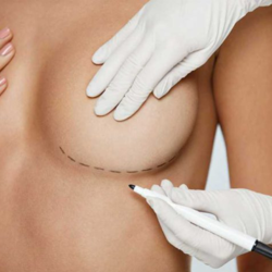 Family Hospital Breast Augmentation Procedure in Mexicali Mexico