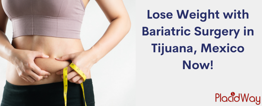 Lose Weight with Bariatric Surgery in Tijuana, Mexico Now!
