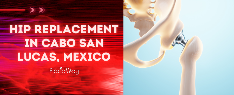 Hip Replacement in Cabo San Lucas, Mexico – Check Prices and Reviews!