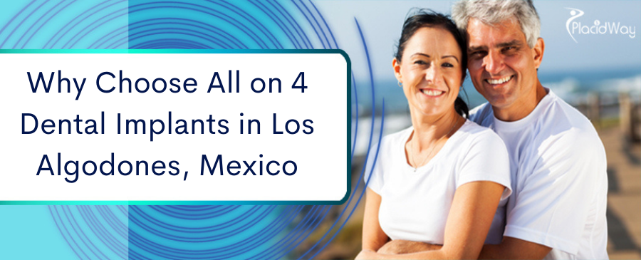 All on 4 Dental Implants in Los Algodones, Mexico 