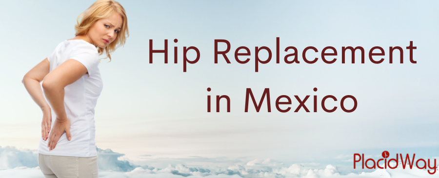 Hip Replacement in Mexico - Affordable Hip Surgery