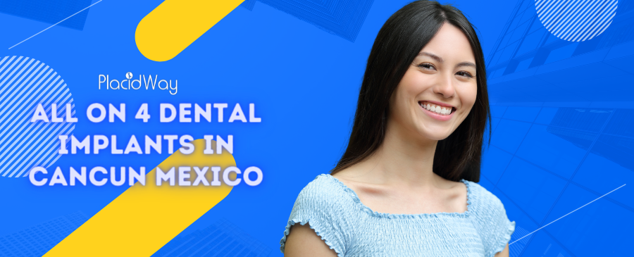 All on 4 Dental Implants in Cancun, Mexico
