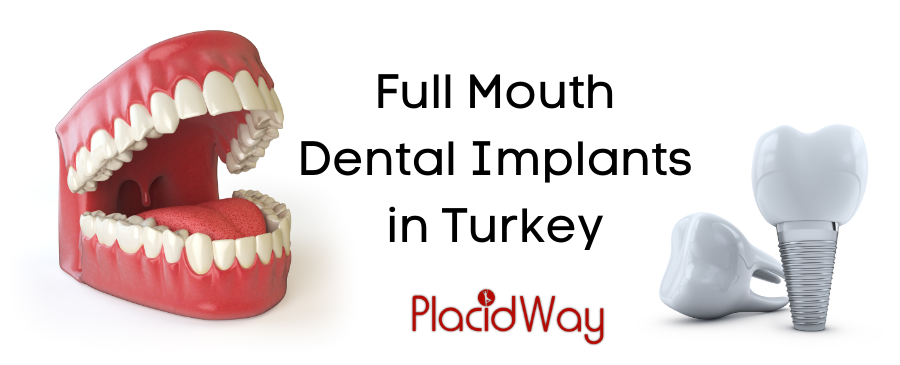 Full Mouth Dental Implants in Turkey - Affordable and Safe
