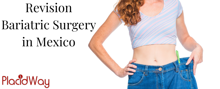 Revision Bariatric Surgery in Mexico 