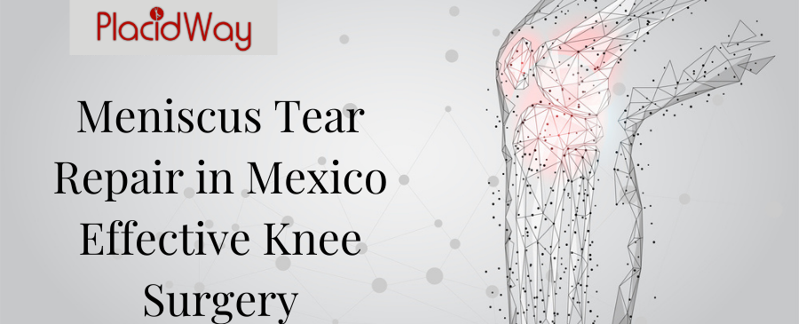 Meniscus Tear Repair in Mexico - Effective Knee Surgery