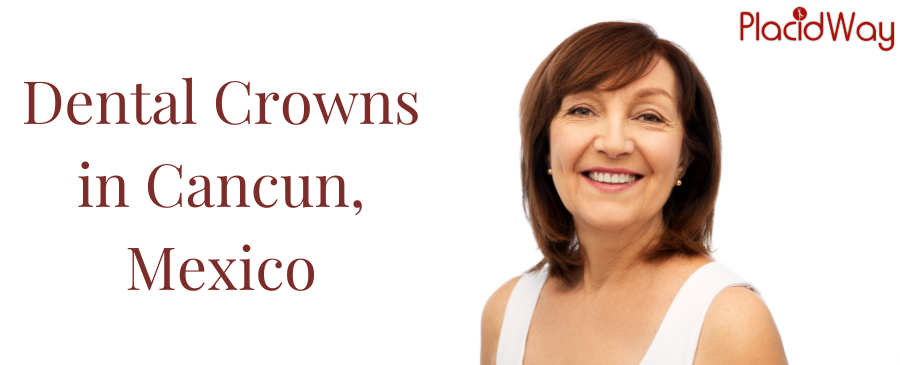 Dental Crowns in Cancun, Mexico