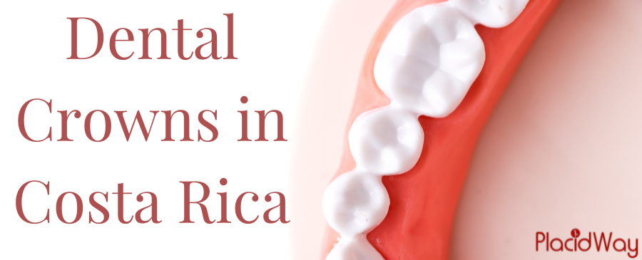 Dental Crowns in Costa Rica