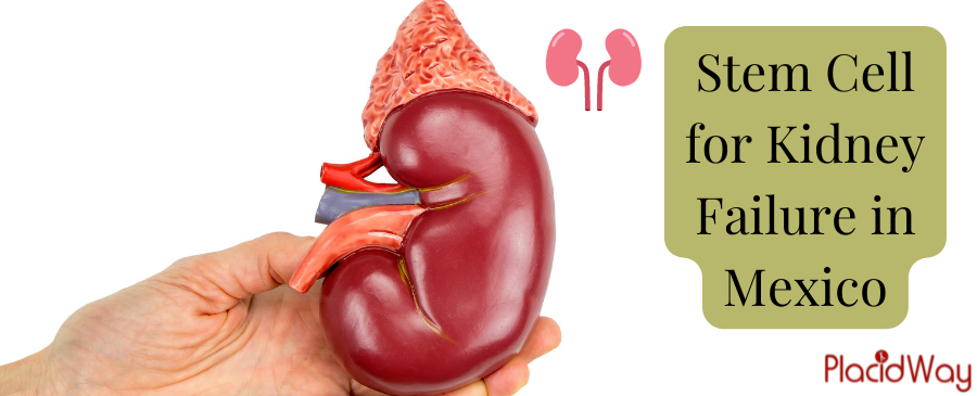 Improve Your Health with Stem Cell for Kidney Failure in Mexico