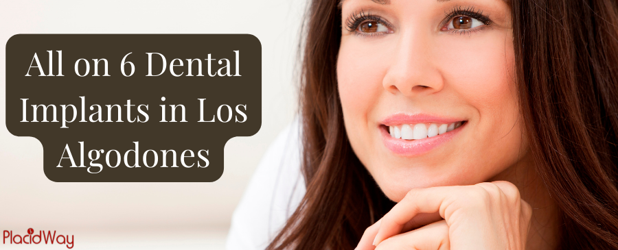 All on 6 Dental Implants in Los Algodones, Mexico