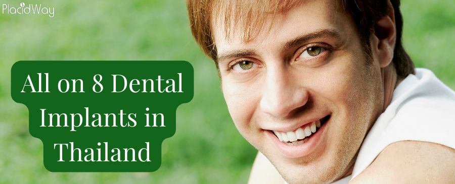 All on 8 Dental Implants in Thailand - Get Dental Implants Abroad 