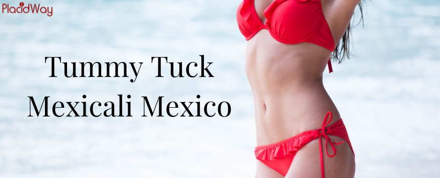 Tummy Tuck in Mexicali, Mexico