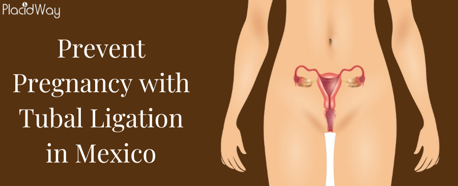 Prevent Pregnancy with Tubal Ligation in Mexico