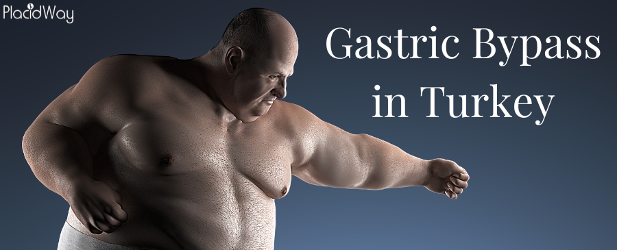 Gastric Bypass in Turkey - Cost, Clinics, Reviews, Doctors