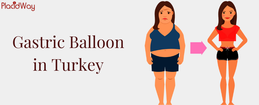 Gastric Balloon in Turkey