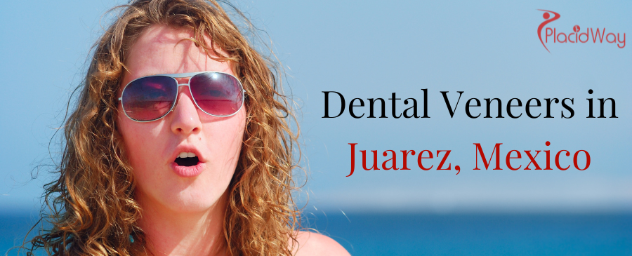Dental Veneers in Juarez, Mexico