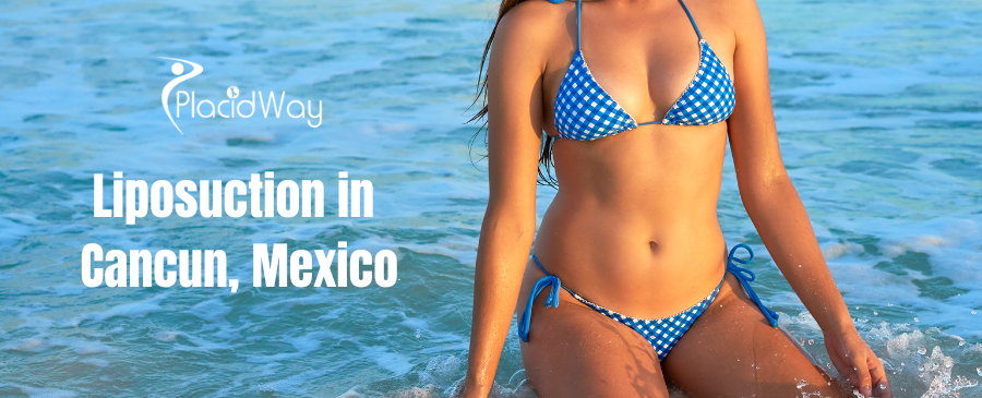 Liposuction in Cancun, Mexico