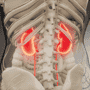 Affordable Stem Cell Therapy for Kidney Failure in Mexico