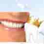 Dental Crowns in Cali, Colombia: Comprehensive Guide on Costs, Types & Benefits
