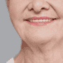 Veneers Cost in Turkey - Best Dental Clinics & Prices