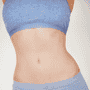 How Safe is Bariatric Surgery, Including Gastric Sleeve Surgery, in Piedras Negras? 