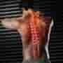 Slovakia's Emerging Stem Cell Treatments for Spinal Cord Injuries: Insights for Romanian Patients